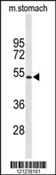 KCNJ11 Antibody (N-term)