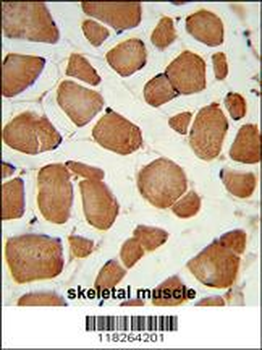 ANGPTL4 Antibody (Center)