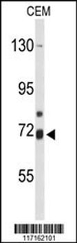 ALOX15B Antibody (C-term)