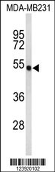 FLAD1 Antibody (C-term)