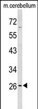 PXMP4 Antibody (Center)