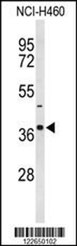 SLC25A17 Antibody (N-term)