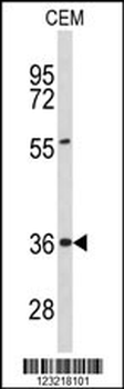 PEX16 Antibody (Center)