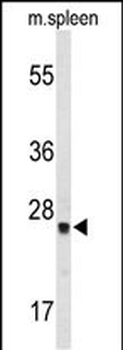 TPK1 Antibody (N-term)