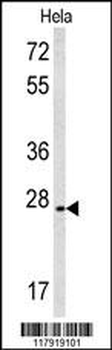 CREM Antibody (C-term)