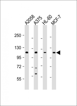 COL17A1 Antibody (Center)