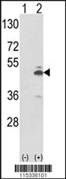PKM2 (N-term E131) Antibody