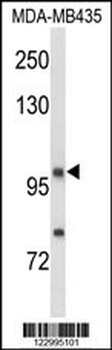 NRP1 Antibody (C-term)