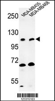 EXTL3 Antibody (N-term)