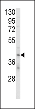 KIR2DL4 Antibody (C-term)
