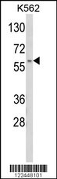 CDK5RAP1 Antibody (C-term)