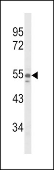 NAMPT Antibody (Center)