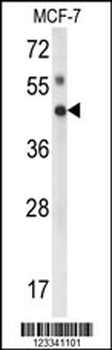 IPMK Antibody (Center)