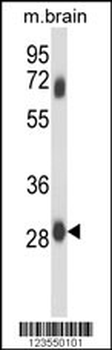 FCGR2C Antibody (C-term)