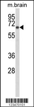 DAB1 Antibody (Center)