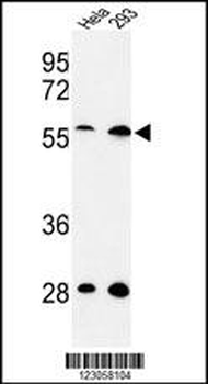 SKA3 Antibody (Center)