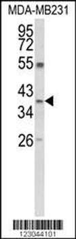 ARG1 Antibody (C-term)