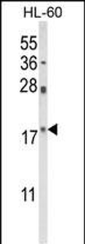 PIN1 Antibody (Center)