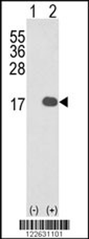 IL1F8 Antibody (N-term)