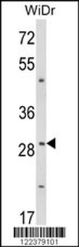 ZFP36 Antibody (Center)