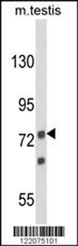 ANGEL1 Antibody (C-term)