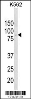 ALDH18A1 Antibody (Center)