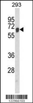 AIFM1 Antibody (N-term)