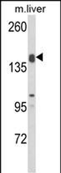 ADAMTS18 Antibody (C-term)