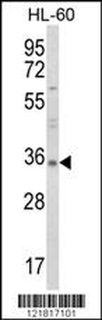 TNFSF11 Antibody (N-term)