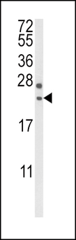 RGS4 Antibody (Center)