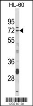 DTX4 Antibody (N-term)