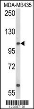 CASD1 Antibody (N-term)