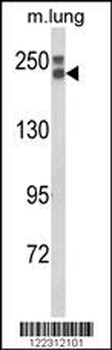 COL18A1 Antibody (N-term)