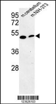 PISD Antibody (Center)