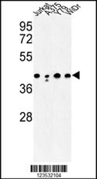 CANT1 Antibody (N-term)