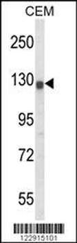 KCNH2 Antibody (Center)