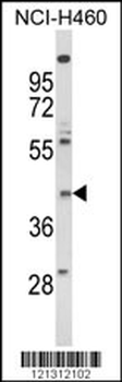 FPRL2 Antibody (Center)