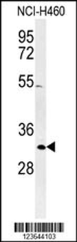 XPA Antibody (C-term)