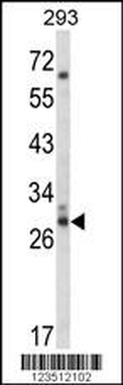 CDC42EP3 Antibody (N-term)