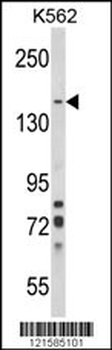 SORCS1 Antibody (N-term)