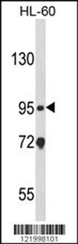 CARD4 Antibody (C-term)