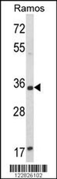ACY3 Antibody (Center)
