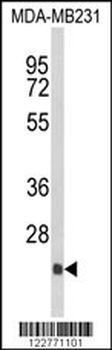 DERL2 Antibody (C-term)