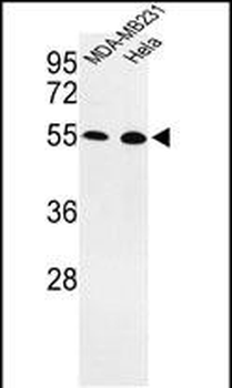EGLN2 Antibody (Center)