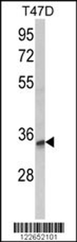 TSPAN12 Antibody (C-term)