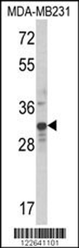 MLX Antibody (Center)