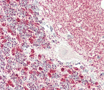KLC1 Antibody (Center)