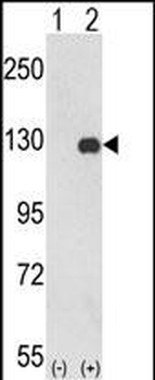 PTK2 Antibody (C-term)