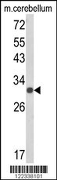 USF2 Antibody (Center)
