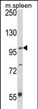ANO5 Antibody (C-term)